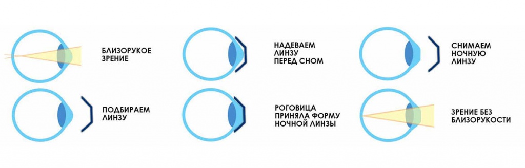 how-work-lens.jpg how-work-lens.jpg