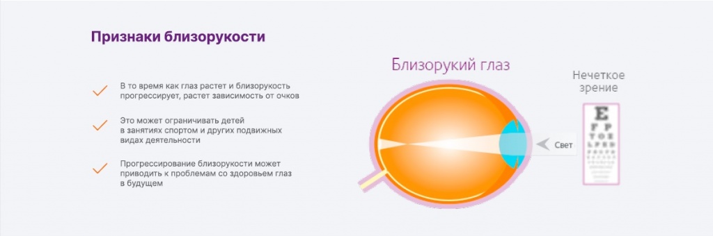 признаки близорукости.jpg признаки близорукости.jpg
